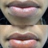 Lip dark/cool tone color correction